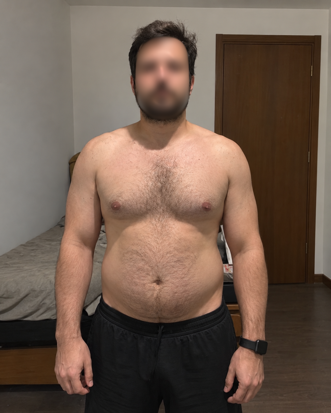 ANTES